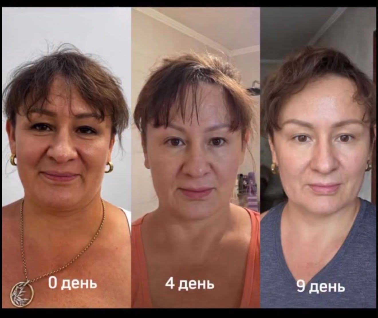 Материал клиента 26